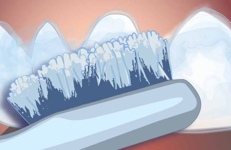 illustration d'un brossage de dents pour le blanchiment, dentisterie esthétique